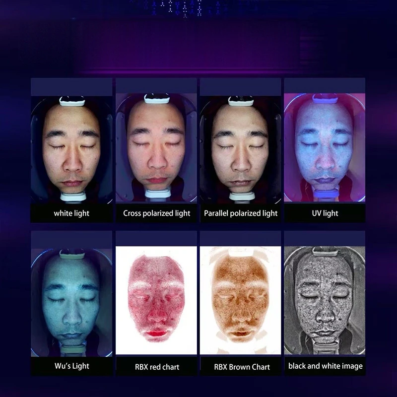 Skin Analyzer Face Analyzing thumbnail 3