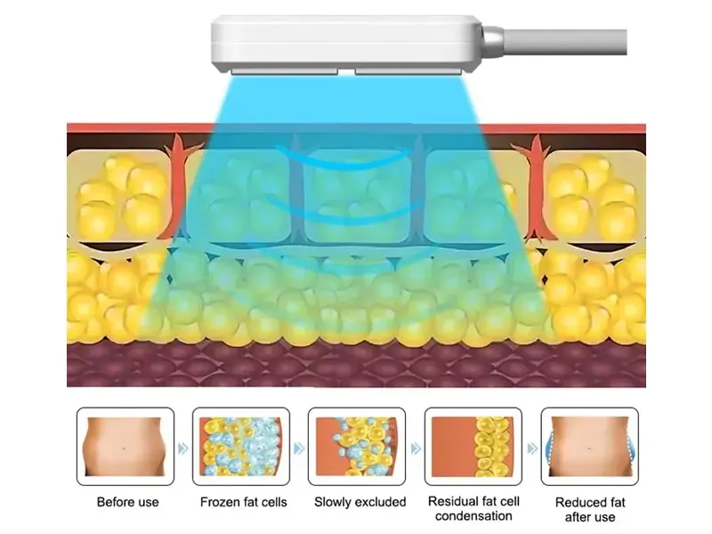 How does the Cooling Pads work?