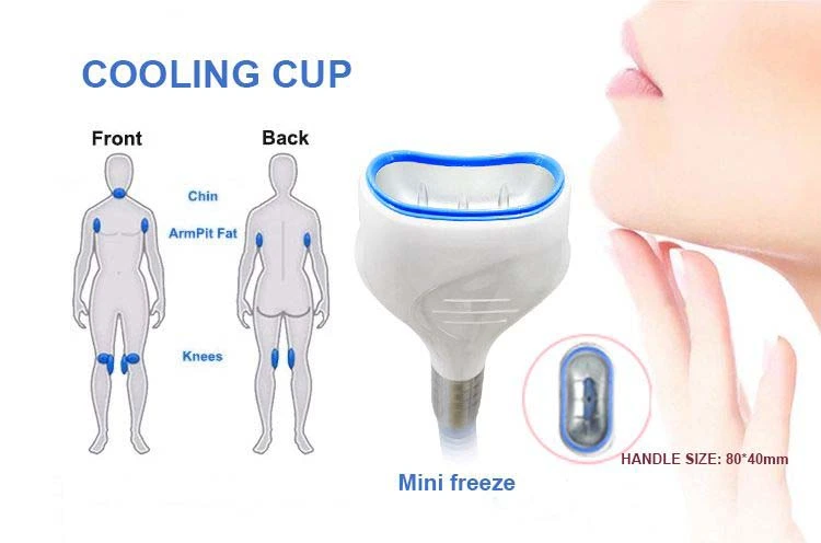 Small cryo handle size