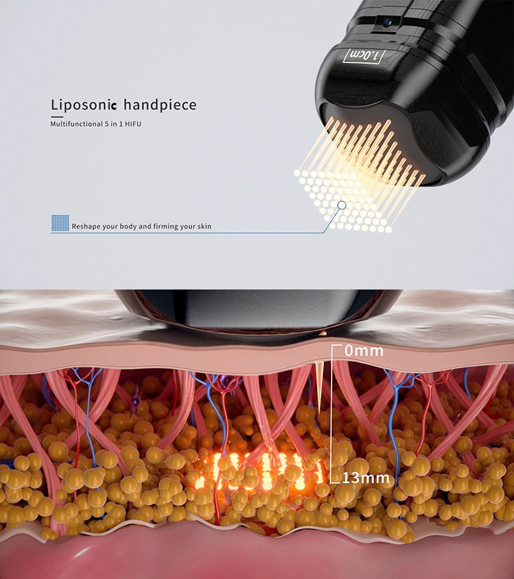 Deep-Fat Handpiece