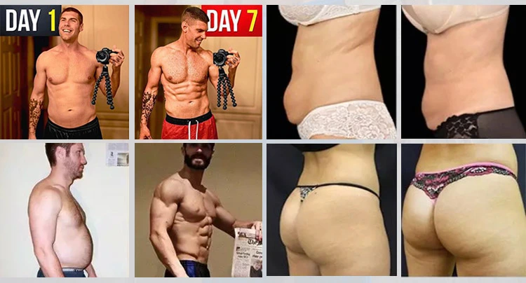 EMS Body Sculpting & Pelvic Health Device Before & After