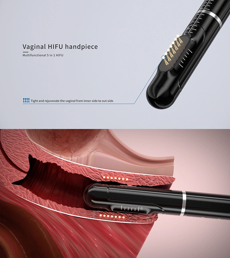 Vaginal HIFU Handpiece