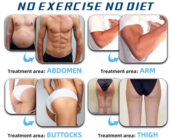Portable EMS Muscle Sculpting Machine Before and After