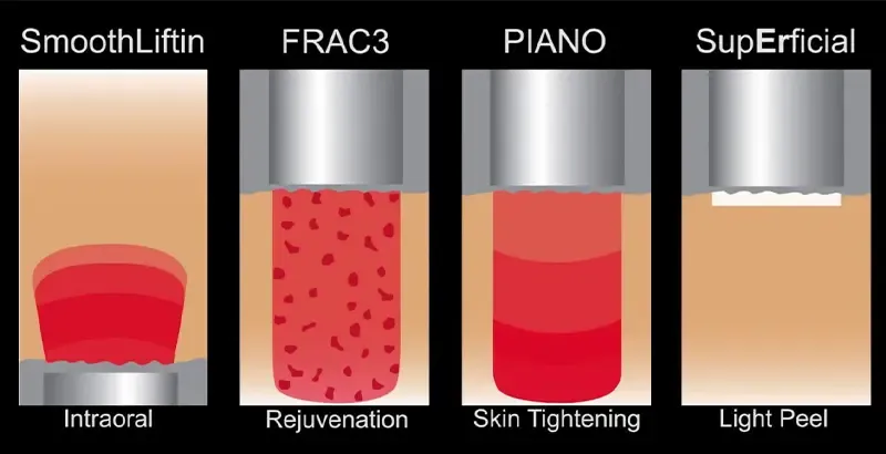 How dual-wavelength laser 4D laser work?