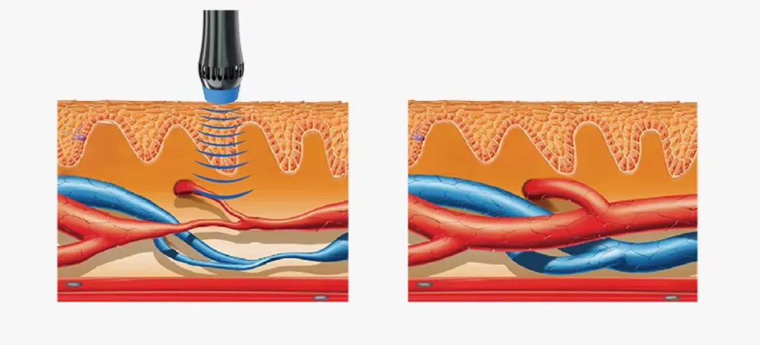 Shockwave Machine Application