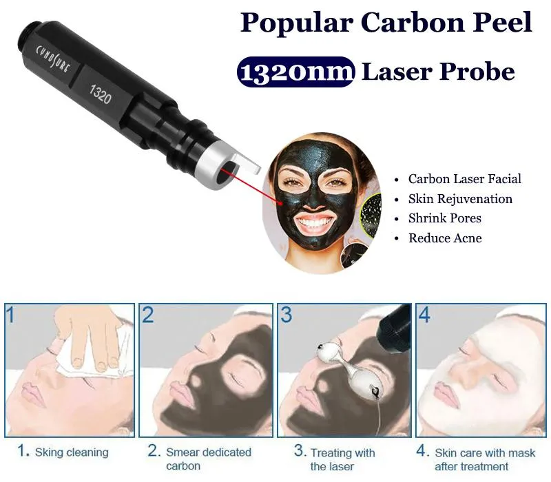 Carbon Peel